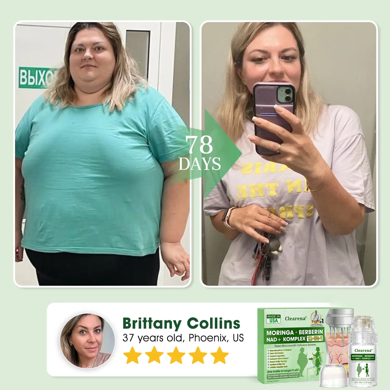 Official Store | โ๏ธ ๐๐ฅ๐๐๐ซ๐๐ง๐ยฎ Nano Microneedle Infusion System๐ฌ โ Moringa ยท Berberine + NAD+ 12-in-1 Metabolic Complex (300% Deeper Absorption, Once Daily, Visible Changes in 7 Days) - Image 4