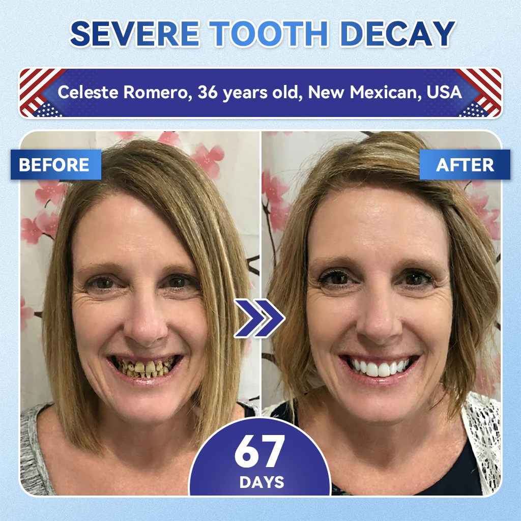 【𝐎𝐟𝐟𝐢𝐜𝐢𝐚𝐥 𝐔𝐒 𝐒𝐭𝐨𝐫𝐞  】ZUEET® 🦷 Tideglusib Fast‑Dissolving Tooth & Gum Repair Oral Strips ✨ (Supports tooth repair and helps relieve gum discomfort and other common oral concerns) - Image 4