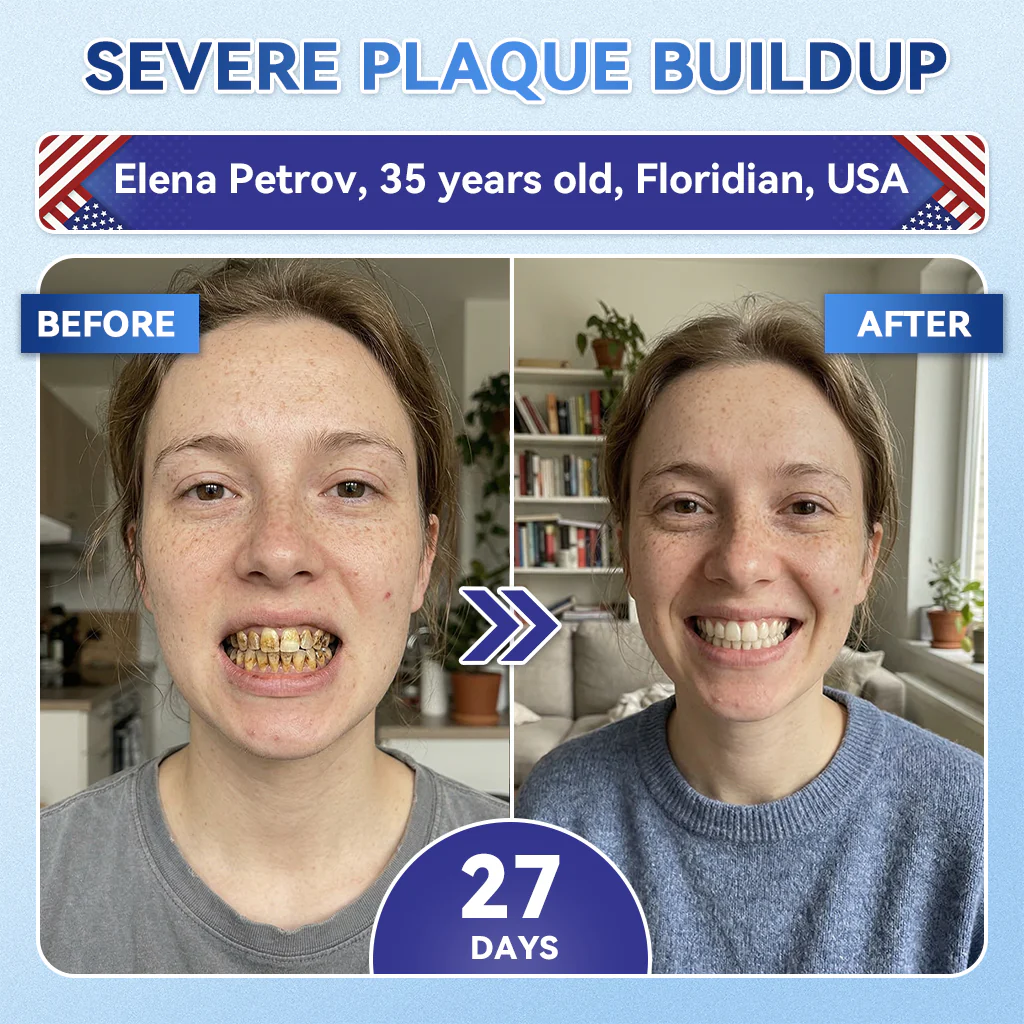 【𝐎𝐟𝐟𝐢𝐜𝐢𝐚𝐥 𝐔𝐒 𝐒𝐭𝐨𝐫𝐞  】ZUEET® 🦷 Tideglusib Fast‑Dissolving Tooth & Gum Repair Oral Strips ✨ (Supports tooth repair and helps relieve gum discomfort and other common oral concerns) - Image 5