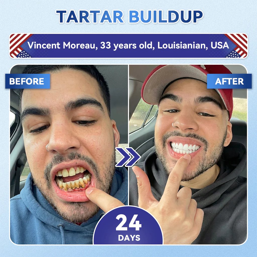 【𝐎𝐟𝐟𝐢𝐜𝐢𝐚𝐥 𝐔𝐒 𝐒𝐭𝐨𝐫𝐞  】ZUEET® 🦷 Tideglusib Fast‑Dissolving Tooth & Gum Repair Oral Strips ✨ (Supports tooth repair and helps relieve gum discomfort and other common oral concerns) - Image 6